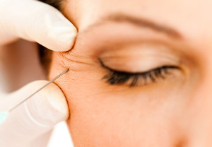 Consejos para el botox en Navidad